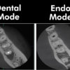 Vatech Smart X CBCT - Image 2