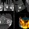 Planmeca ProMax 3D Classic - Image 8