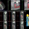 Planmeca ProMax 3D Classic - Image 11